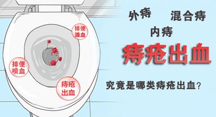 昆明东大肛肠医院专业吗？出现便血，该如何分辨是哪类痔疮出血